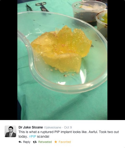 <a href="/MHRAgovuk/">MHRAgovuk</a> claimed #breastfeeding with #PIP #breastimplants “no cause for concern” Surgeons have concerns <a href="/DHSCgovuk/">Department of Health and Social Care</a> <a href="/wesstreeting/">Wes Streeting</a> <a href="/PutneyFleur/">Fleur Anderson MP</a> <a href="/PSCommissioner/">Patient Safety Commissioner</a> <a href="/JuliaCumberlege/">Julia Cumberlege</a> <a href="/EstherMcVey1/">Esther McVey</a> <a href="/FeryalClark/">Feryal Clark MP</a> <a href="/DanCardenMP/">Dan Carden</a> <a href="/RupertLowe10/">Rupert Lowe MP</a> #scientificFRAUD