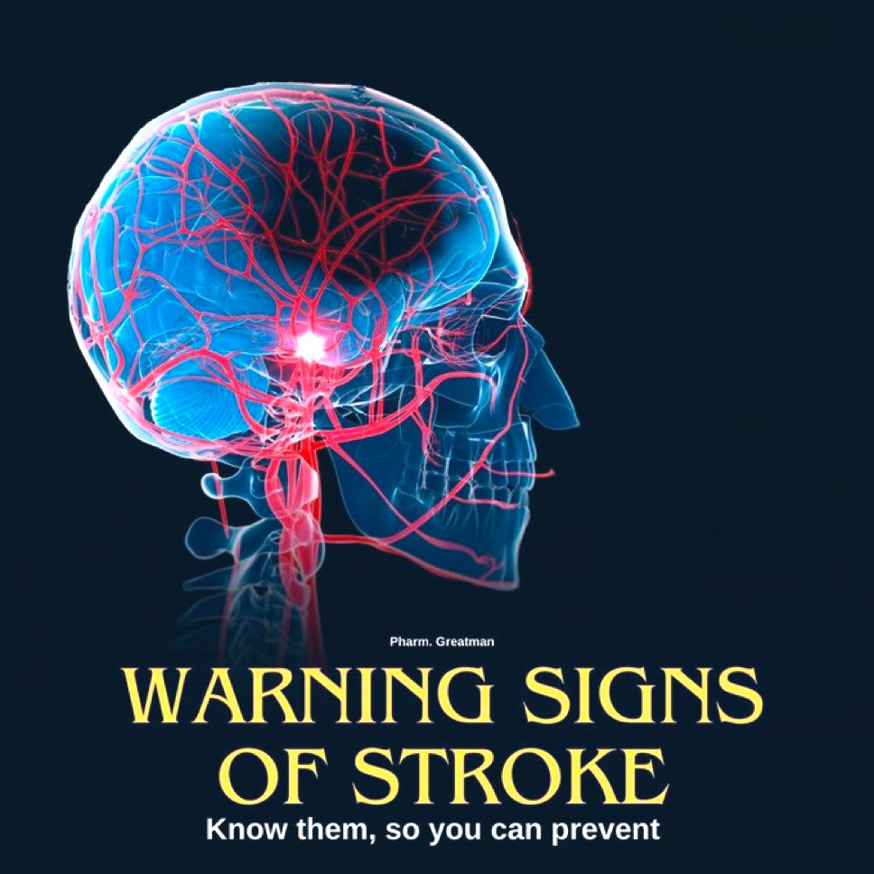 LEARN THE WARNING SIGNS OF STROKE

A stroke can happen anytime, often without warning 🥲

Knowing the signs can save lives and prevent long-term damage. 

Bookmark 👍🏼