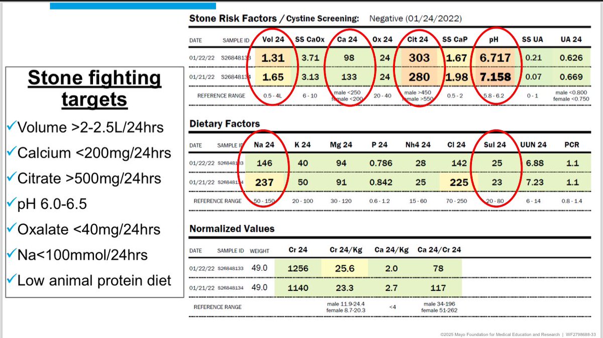 Bright Thilagar (@bthilagarmd) on Twitter photo Great slide on important stone fighting targets on a 24 hr urine study by <a href="/keddis_mira/">Mira Keddis,MD,FACP</a> in STIM2025 #MayoSTIM #STIM2025 Are you getting one in your patients with a kidney stone? Great slide on important stone fighting targets on a 24 hr urine study by <a href="/keddis_mira/">Mira Keddis,MD,FACP</a> in STIM2025 #MayoSTIM #STIM2025 Are you getting one in your patients with a kidney stone?