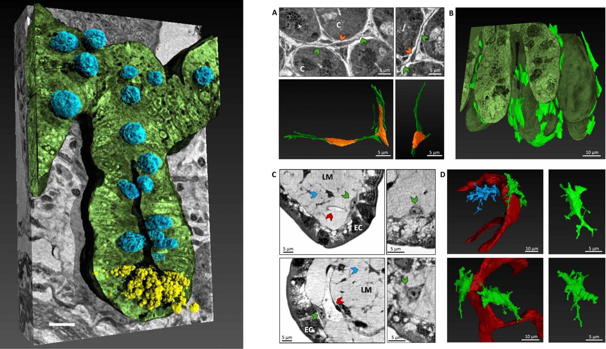 Eric Topol (@erictopol) on Twitter photo Precise 3D Imaging of the gut-brain axis in the Alzheimer's disease model
science.org/doi/10.1126/sc…
<a href="/ScienceAdvances/">Science Advances</a> open-access Precise 3D Imaging of the gut-brain axis in the Alzheimer's disease model
science.org/doi/10.1126/sc…
<a href="/ScienceAdvances/">Science Advances</a> open-access