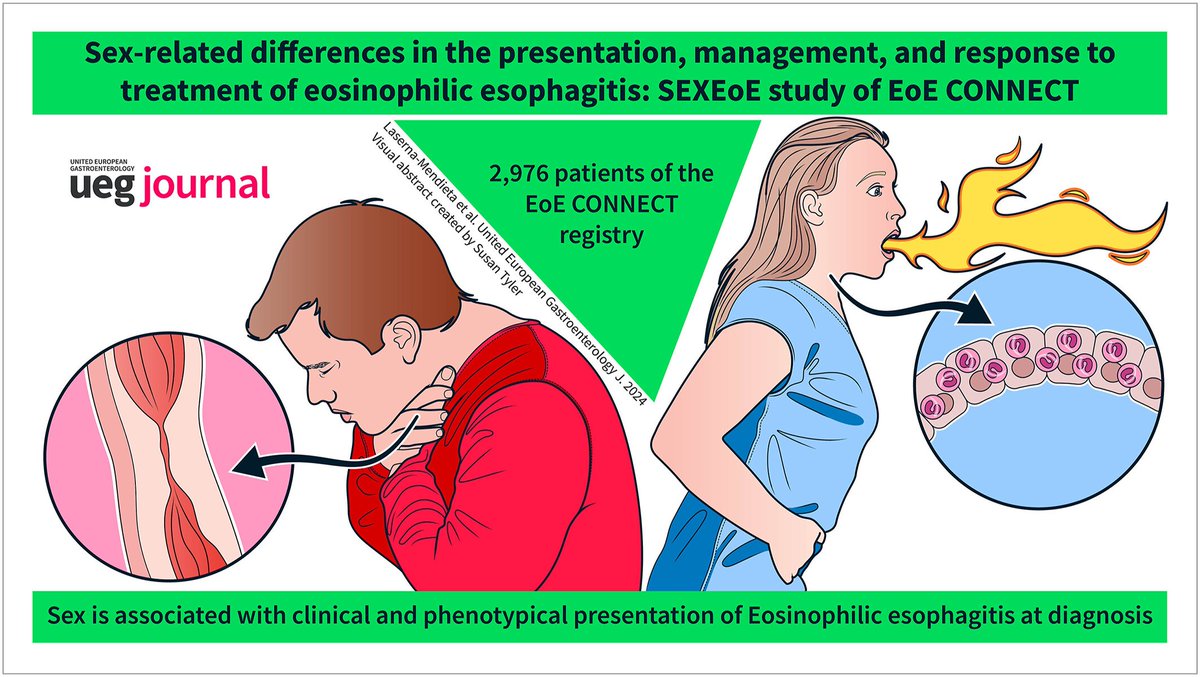 Esofagitis eosinofílica, ♂️vs♀️

-♂️: diag + joven; > impactaciones; > patrón estenótico/mixto; > EREFS

-♀️: > disfagia, ardor, regurgitación y dolor; síntomas > intensos (DSS score); > eosinófilos; > dermatitis atópica

- Niños:♀️≈♂️ (exc + impactac♂️)

onlinelibrary.wiley.com/doi/10.1002/ue…