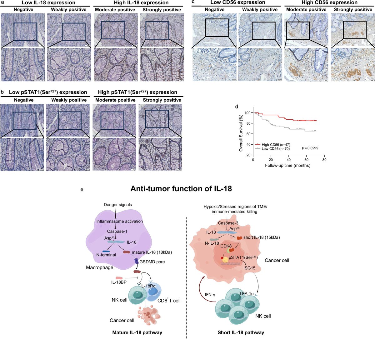 Waggoner Lab (@labwaggoner) on Twitter photo Short IL-18 generated by caspase-3 cleavage mobilizes NK cells to suppress tumor growth
nature.com/articles/s4159…
<a href="/NatImmunol/">Nature Immunology</a> Short IL-18 generated by caspase-3 cleavage mobilizes NK cells to suppress tumor growth
nature.com/articles/s4159…
<a href="/NatImmunol/">Nature Immunology</a>