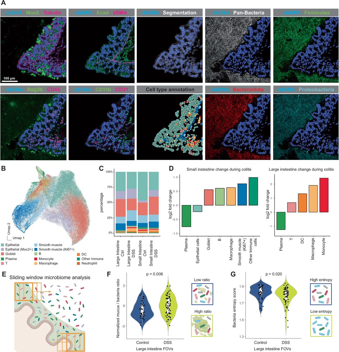 Waggoner Lab (@labwaggoner) on Twitter photo A multi-omics spatial framework for host-microbiome dissection within the intestinal tissue microenvironment
nature.com/articles/s4146…
<a href="/SizunJ/">Sizun Jiang</a> <a href="/GarryPNolan/">Garry P. Nolan</a> <a href="/ZhuBokai/">Bokai Zhu</a> A multi-omics spatial framework for host-microbiome dissection within the intestinal tissue microenvironment
nature.com/articles/s4146…
<a href="/SizunJ/">Sizun Jiang</a> <a href="/GarryPNolan/">Garry P. Nolan</a> <a href="/ZhuBokai/">Bokai Zhu</a>