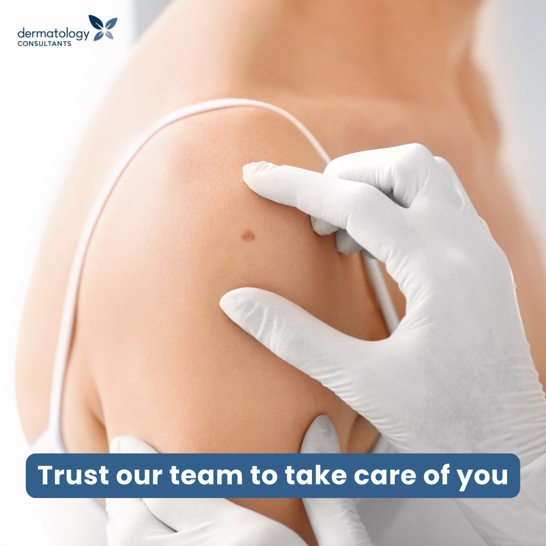 DermMN's tweet photo. We know a skin cancer diagnosis can be overwhelming. We're here to help. 

Mohs surgery offers precise removal with the highest cure rates. Our skilled surgeons carefully remove and examine cancerous skin layers, ensuring all cancer is gone while preserving healthy skin. 

Thi... https://t.co/EsX18wJbFS