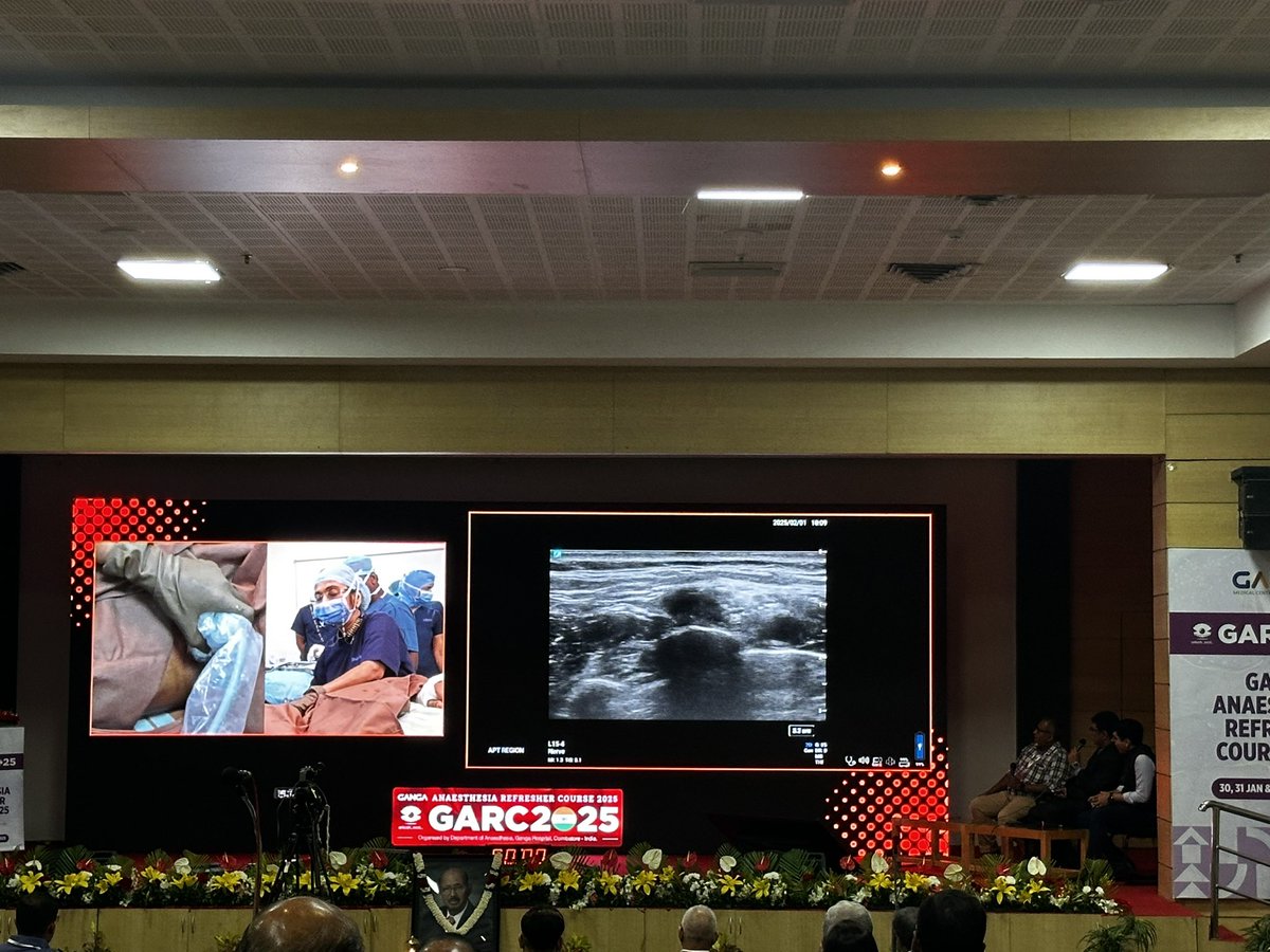 Shilpa Bhat (@shilpabhat04) on Twitter photo What a fantastic start to the day!The highlight of #GARC25, the Live Nerve Block Workshop has kicked off in full swing. The excitement among attendees is palpable as <a href="/vrushali_ponde/">Vrushali Ponde</a> demonstrates the subclavian perivascular block <a href="/BalavenkatSubr1/">Balavenkat Subramanian</a> <a href="/anesthetix/">Amjad Maniar</a> <a href="/tsmurali/">Murali Thondebhavi</a> <a href="/AoraIndia/">AORA India</a> What a fantastic start to the day!The highlight of #GARC25, the Live Nerve Block Workshop has kicked off in full swing. The excitement among attendees is palpable as <a href="/vrushali_ponde/">Vrushali Ponde</a> demonstrates the subclavian perivascular block <a href="/BalavenkatSubr1/">Balavenkat Subramanian</a> <a href="/anesthetix/">Amjad Maniar</a> <a href="/tsmurali/">Murali Thondebhavi</a> <a href="/AoraIndia/">AORA India</a>