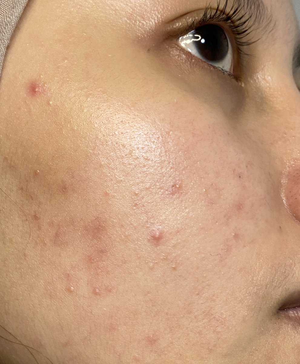blissfulfancy's tweet photo. my updated skincare routine versi lebih SIMPLE⤵️ (non sponsored) 

akhir 2024                             awal 2025 https://t.co/sOOtxqigdU