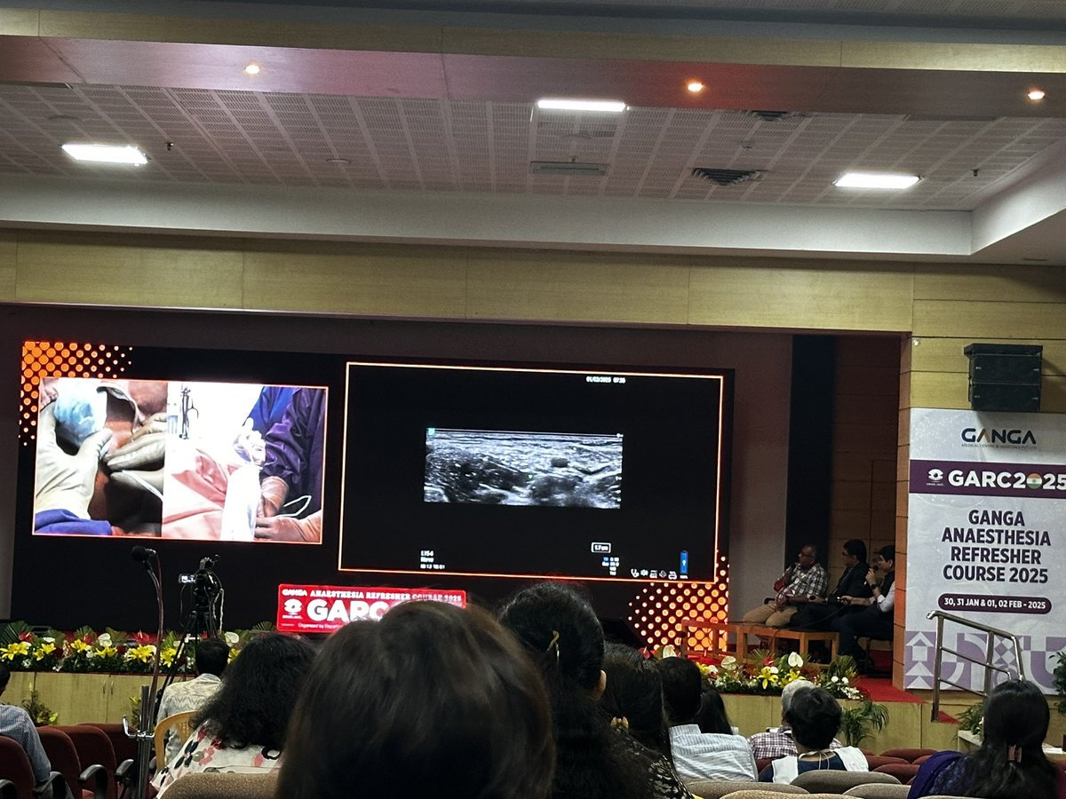 Shilpa Bhat (@shilpabhat04) on Twitter photo Incredible demonstration by <a href="/DrRiteshRoy1/">Prof Dr Ritesh Roy</a> at #GARC25 on femoral and lateral femoral cutaneous nerve blocks! His precision and insightful tips, particularly blocking the LFCN above the sartorius, were truly impressive. A must-see for all in the field!
<a href="/BalavenkatSubr1/">Balavenkat Subramanian</a> <a href="/tsmurali/">Murali Thondebhavi</a> Incredible demonstration by <a href="/DrRiteshRoy1/">Prof Dr Ritesh Roy</a> at #GARC25 on femoral and lateral femoral cutaneous nerve blocks! His precision and insightful tips, particularly blocking the LFCN above the sartorius, were truly impressive. A must-see for all in the field!
<a href="/BalavenkatSubr1/">Balavenkat Subramanian</a> <a href="/tsmurali/">Murali Thondebhavi</a>