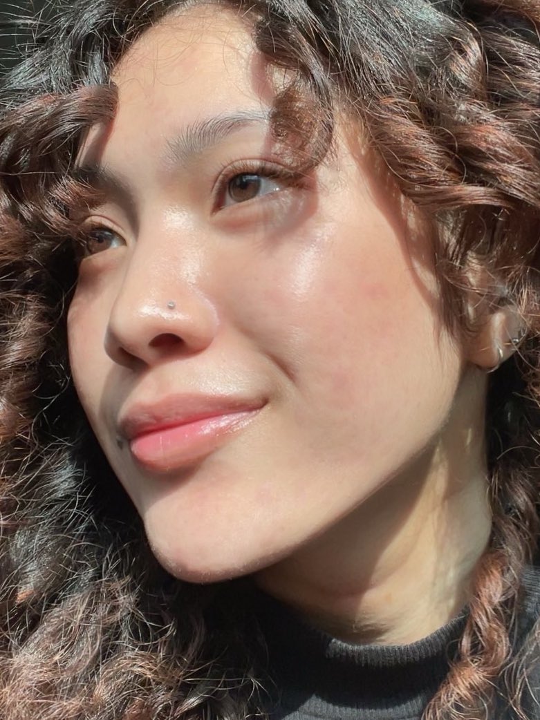 yanaazmill's tweet image. As an acne survivor, you really do need loads of patience, a healthy lifestyle, and definitely a few trial and errors when it comes to the products😭

I'll share my acne journey, and what I did in this thread. I managed to clear my skin within a year🥹🫶🏻