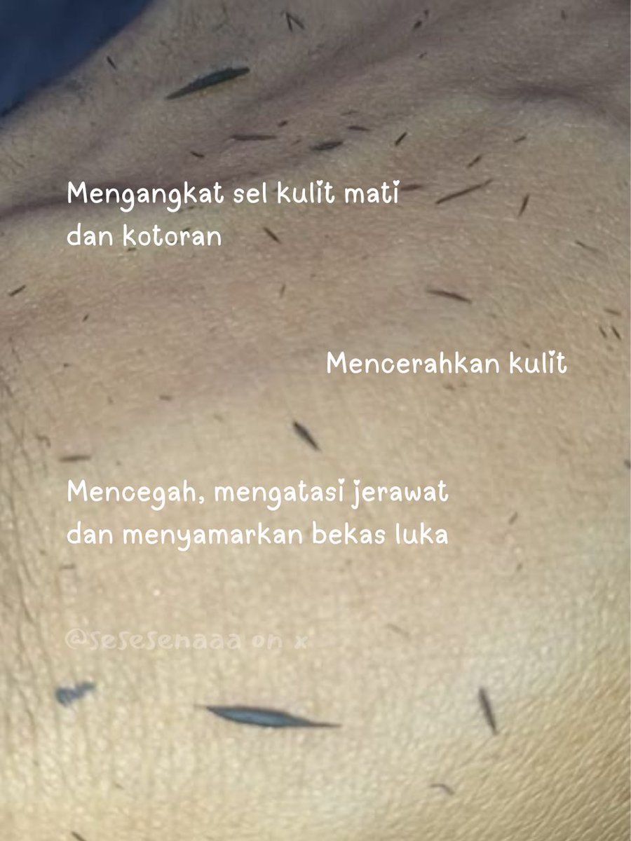 sesesenaaa's tweet photo. Awalnya ga nyangka, tapi setelah coba ๐ ๐ฎ๐ด๐ถ๐ฐ ๐ฆ๐ฐ๐ฟ๐๐ฏ ๐๐๐๐ ๐ฒ satu ini, hasilnya bikin kaget! ๐คฉโจ
Sel kulit mati & kotoran keangkat seketika, kulit jadi cerah dan halus dalam sekali pakai. Beneran sebagus itu! Yuk cobain! ๐งก
#KeadilanKecantikan #MagicScrub https://t.co/Sj9H6jOfvc