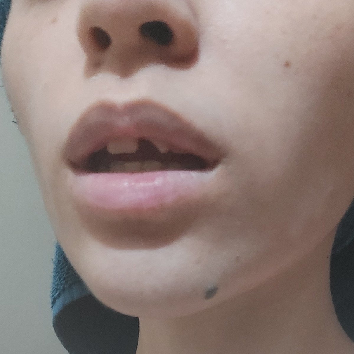 acey 🇲🇽 tweet media