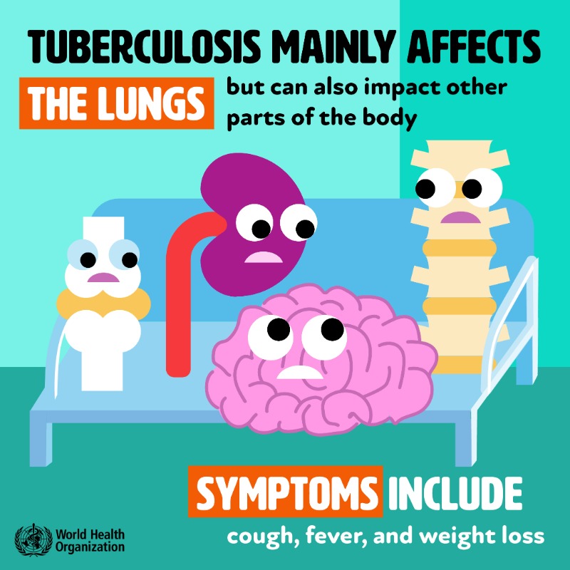 WHO's tweet photo. #Tuberculosis - or TB - is caused by bacteria Mycobacterium tuberculosis that mainly affects the lungs.

Common symptoms incl.:
🫁 Cough
🫁 Chest pains
🫁 Weight loss
🫁 Fever
🫁 Night sweats

Learn more about TB https://t.co/0jbErIdMy6 

#EndTB