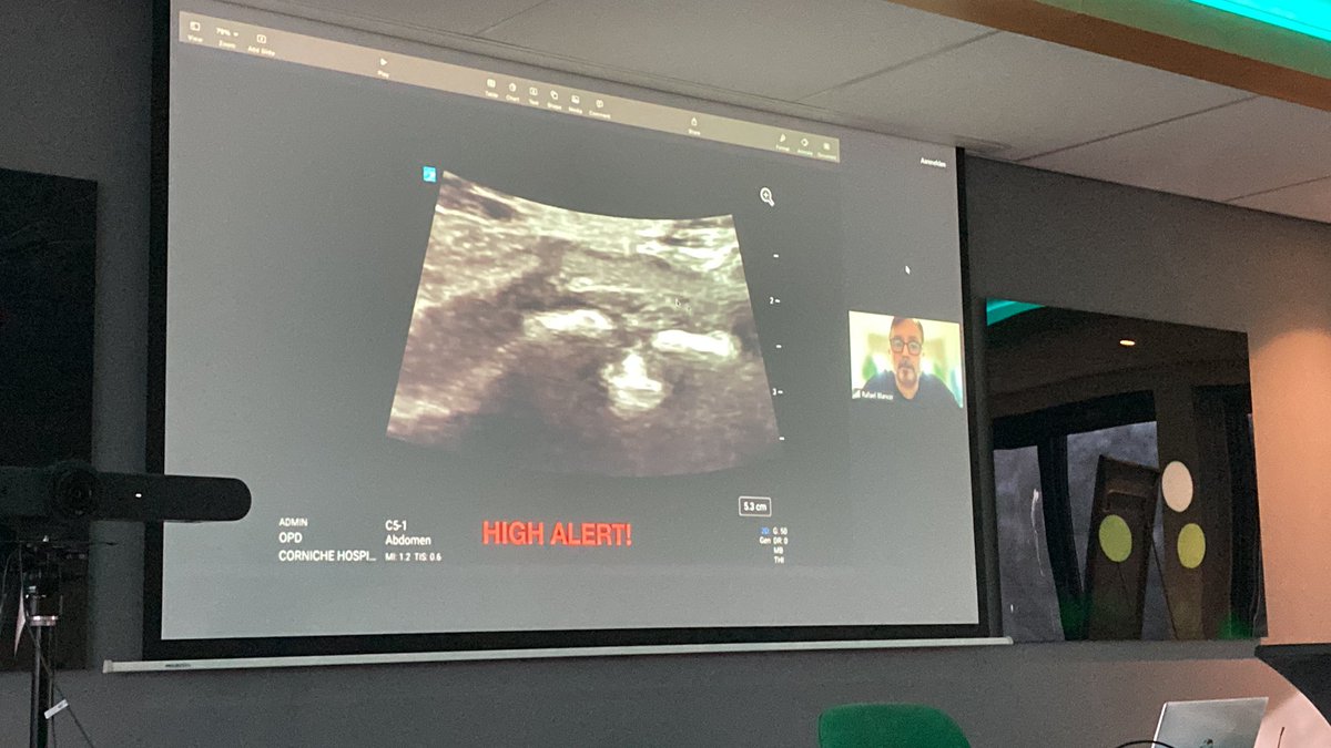 ashwani_doc's tweet photo. @200UB313 teaching us about the pelvic pain in pregnant women which is not given enough attention but is a serious problem which needs addressing urgently. A very passionate talk @DaraEsra @ESRA_Society
#transitionalpain services need to be set up for these patients https://t.co/2GpV5i2Wnv