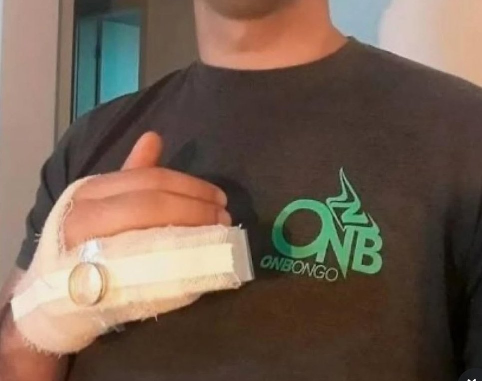 baruablasi's tweet photo. Bartın'da eşinin yüzüğünü takmadığına sinirlenen kadın, eşinin parmağ��nı kırdı https://t.co/i5AfvG0IQX