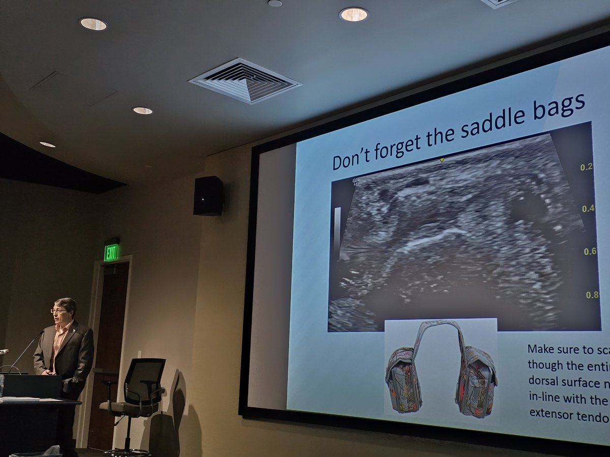 Dr. Gene Kissin "Don't forget the saddle bags!" Look for synovitis on medial &amp; lateral aspect of synovium, not just midline
#RA #tenosynovitis #effusion #synovitis #rheumatology  #POCUS #ultrasound #meded #arthritis