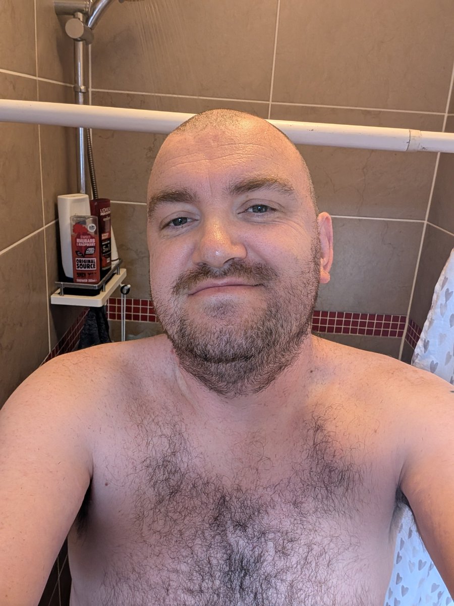 Hair shaved off, beard growing well.
