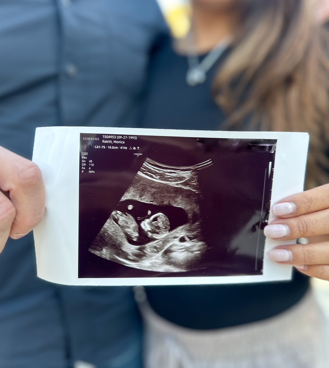 Baby girl Rakitt coming Summer 2025 🩷