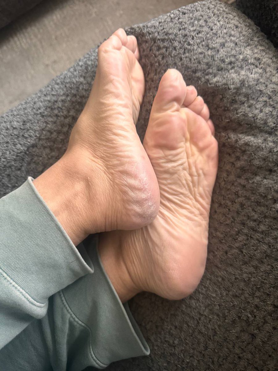 Morning treats.