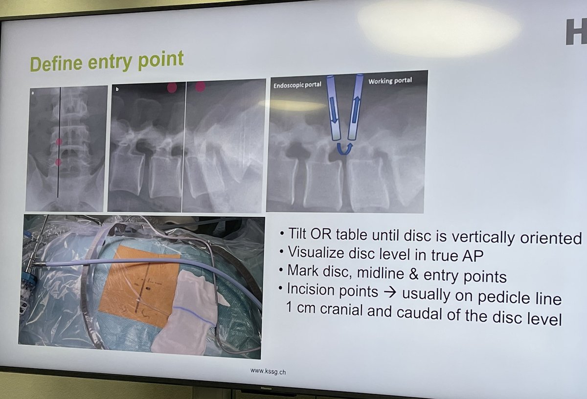 ukneurosurgeon's tweet image. #UBE in Switzerland with @EdgeMedicalUK and Nexon and some colleagues from London
Thanks to edge medical for supporting us
Excellent course!