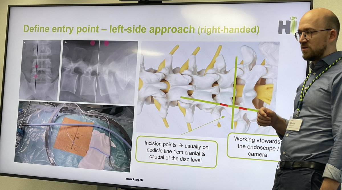 ukneurosurgeon's tweet image. #UBE in Switzerland with @EdgeMedicalUK and Nexon and some colleagues from London
Thanks to edge medical for supporting us
Excellent course!