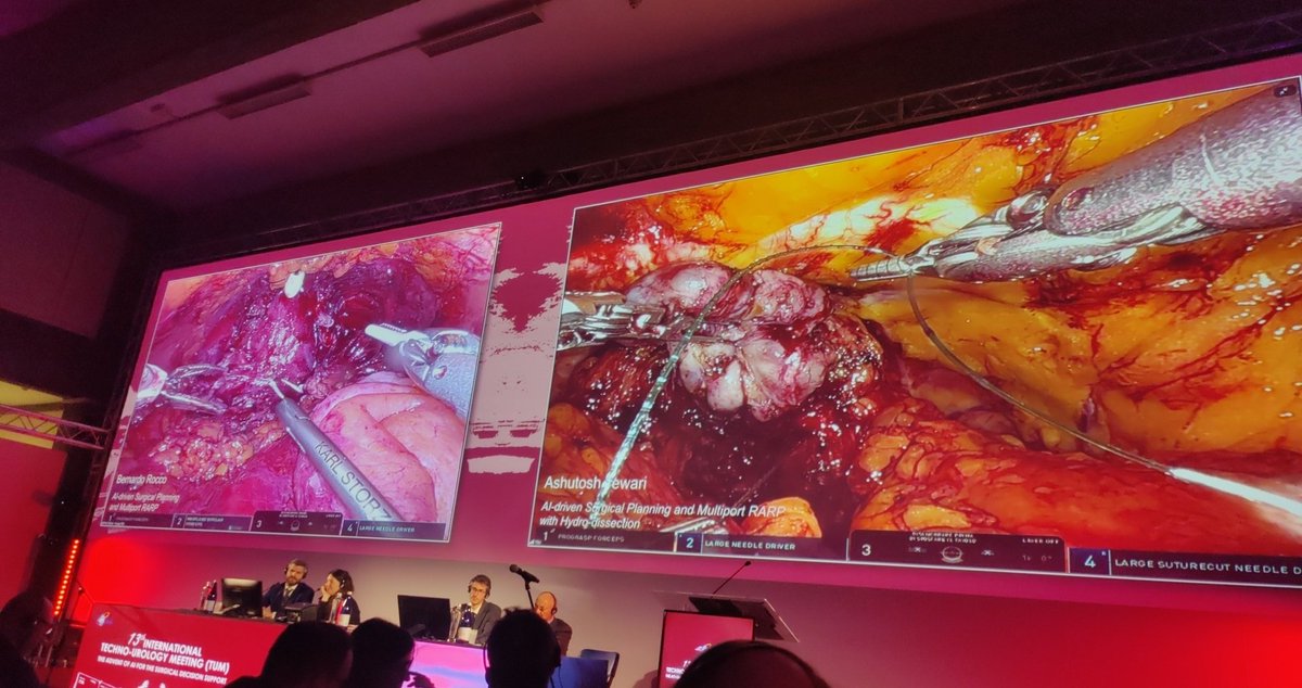 Andrea Mari (@andreamari08) on Twitter photo Thrilled to attend <a href="/TechnoUro/">13th Techno-Urology Meeting (TUM)</a> #TUM25 in Turin. For first time #AI-equipped #avatar aided in pre-op planning. Honored to assist Prof <a href="/minerviniandre/">Andrea Minervini</a> and moderate Prof <a href="/aleantonellibs1/">Alessandro Antonelli MD FRCS(Glasg)</a> during complex renal surgeries. Thanks to <a href="/PorpigliaF/">Porpiglia Francesco</a> and <a href="/danieleamparore/">Daniele Amparore</a> for a fantastic event. Thrilled to attend <a href="/TechnoUro/">13th Techno-Urology Meeting (TUM)</a> #TUM25 in Turin. For first time #AI-equipped #avatar aided in pre-op planning. Honored to assist Prof <a href="/minerviniandre/">Andrea Minervini</a> and moderate Prof <a href="/aleantonellibs1/">Alessandro Antonelli MD FRCS(Glasg)</a> during complex renal surgeries. Thanks to <a href="/PorpigliaF/">Porpiglia Francesco</a> and <a href="/danieleamparore/">Daniele Amparore</a> for a fantastic event.