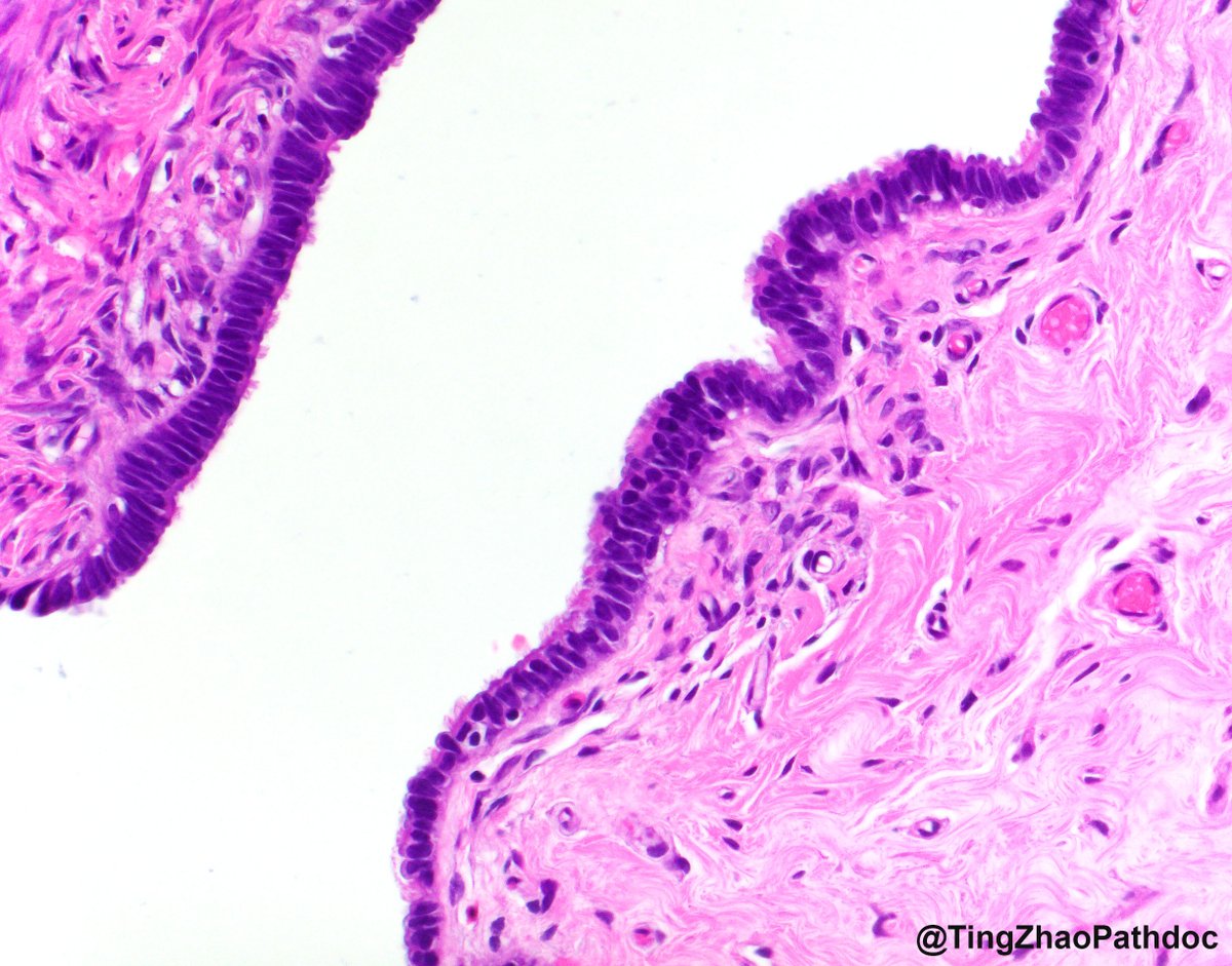 What is the structure in the photos?
<a href="/MGBpathology/">Mass General Brigham Pathology</a>  <a href="/MGHPathology/">MGH Pathology</a>