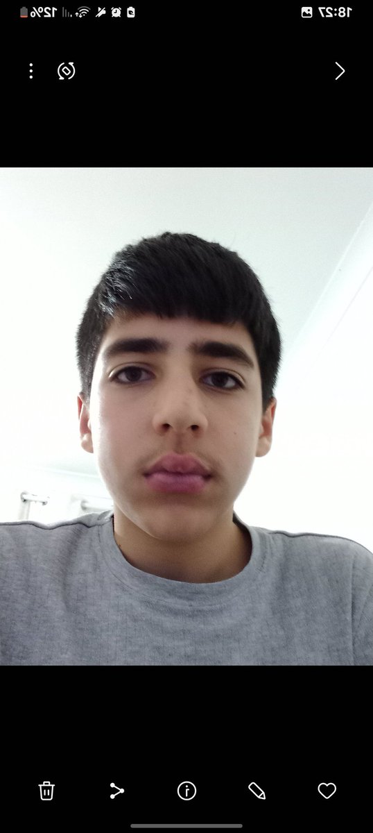 𝐅𝐫𝐚𝐧𝐳 tweet media