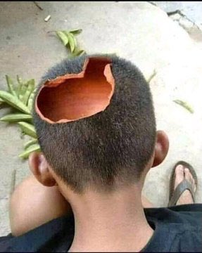 LastWeekBut2day's tweet photo. @DOE_Lawsuit @skhalo_xolo This is your head so fuckin empty like your mom's head. You didn't fall far from the tree (your mom) rotten apple. https://t.co/nWtXxWQIpy