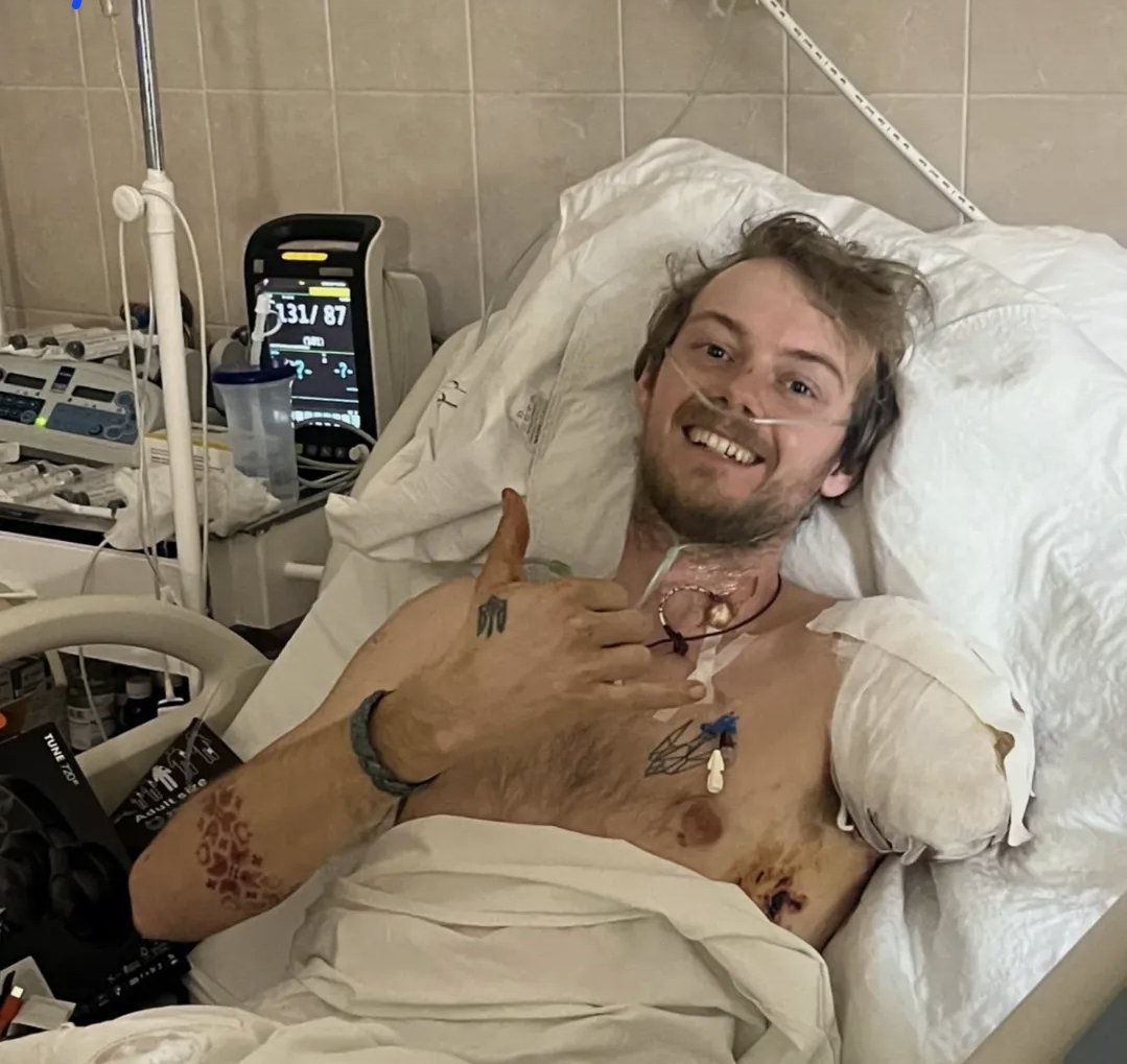 rima_medUA's tweet image. I NEED ALL HANDS ON DECK RIGHT NOW. 

#NAFOfellas PLEASE SHARE 

My good friend Eddy -father of Ice Cream, a British volunteer who's been tirelessly working to help Ukraine has been seriously injured when his HUMANITARIAN evacuation vehicle was targeted by orcs via FPV drone. His…