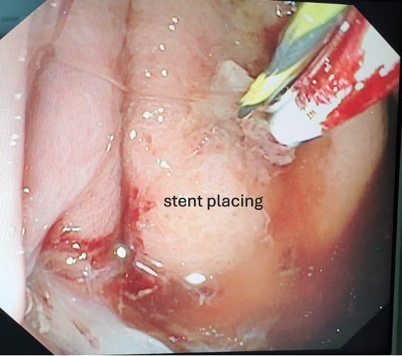 Srinu Deshidi tweet media