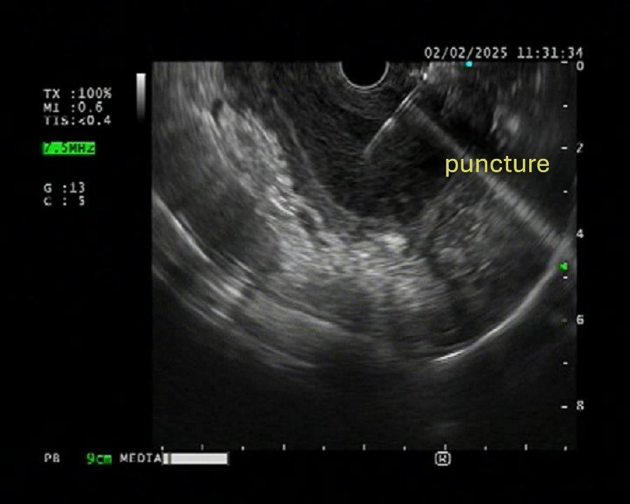 Srinu Deshidi tweet media