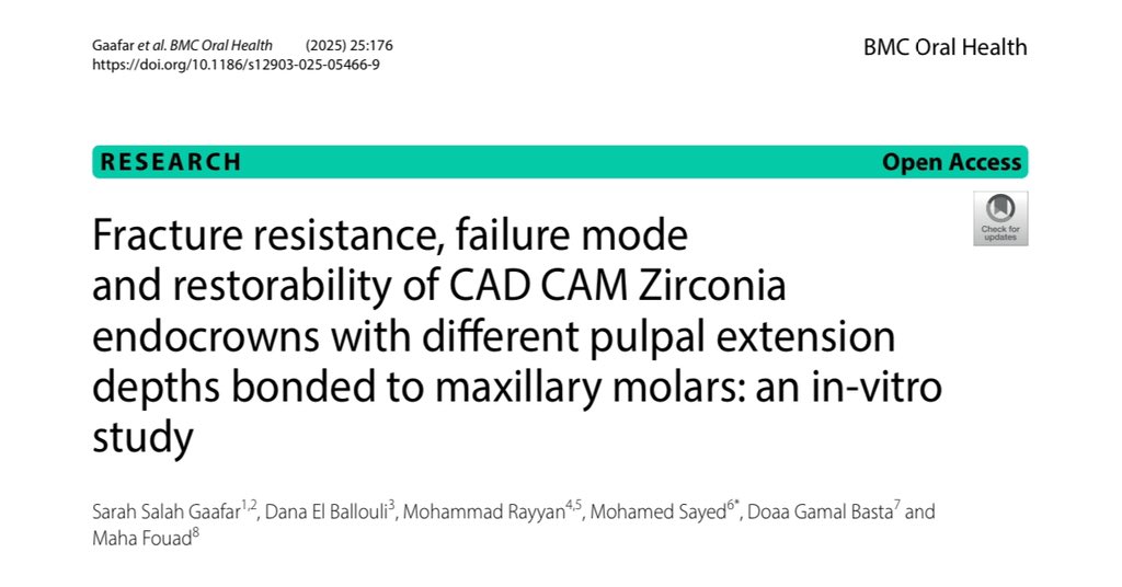 mohdent29's tweet photo. Read my latest #research on [#Zirconia_Endocrown], published with @SpringerNature in [ @BioMedCentral ] Read here: [ https://t.co/tZgNIIffmW ] https://t.co/skfcOABqxb
