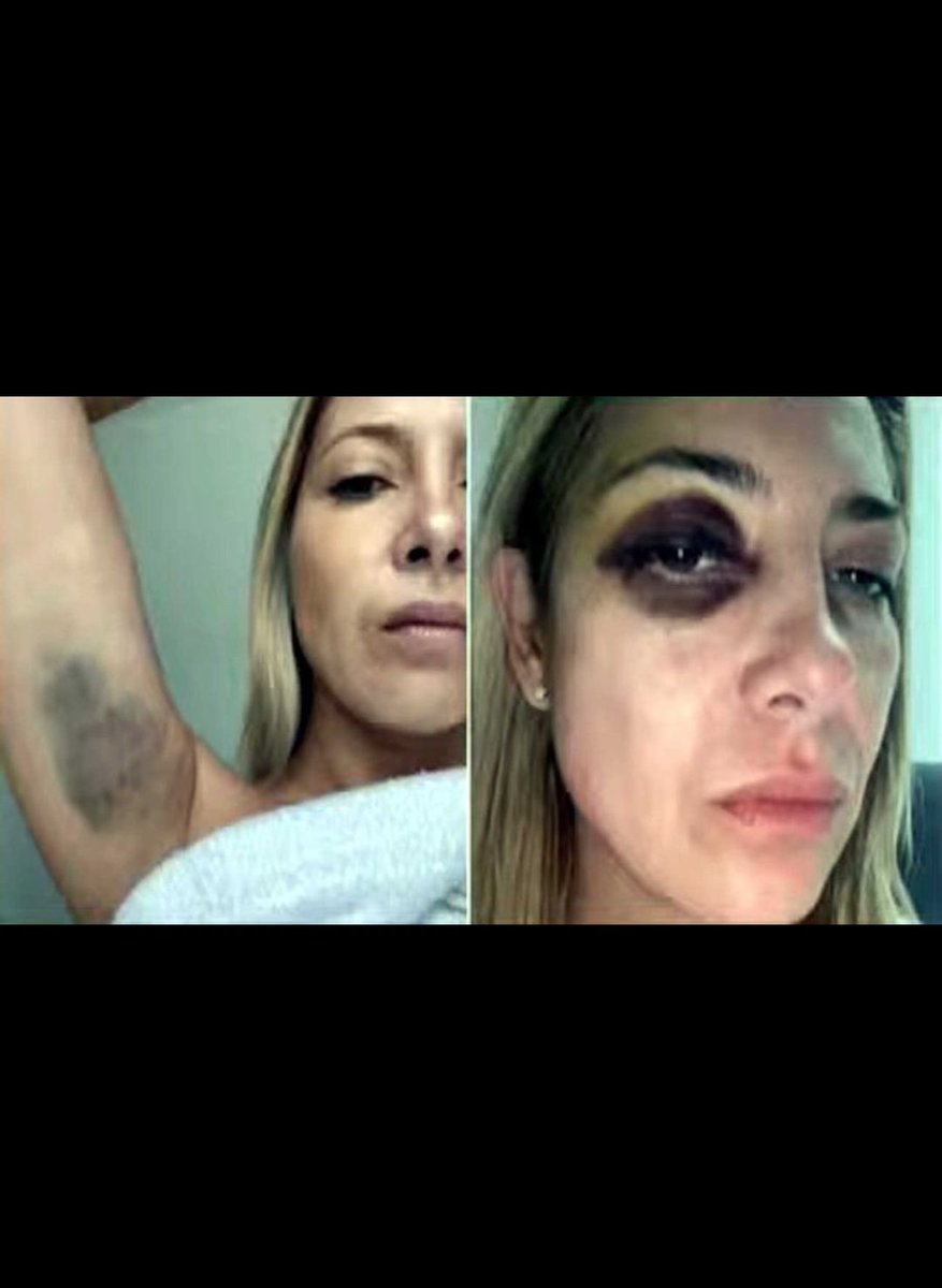 <a href="/biobio/">BioBioChile</a> Cuando este zurdo era presidente, asi maltrataba a su mujer. Pero los zurdos y las feministas no salían a protestar.