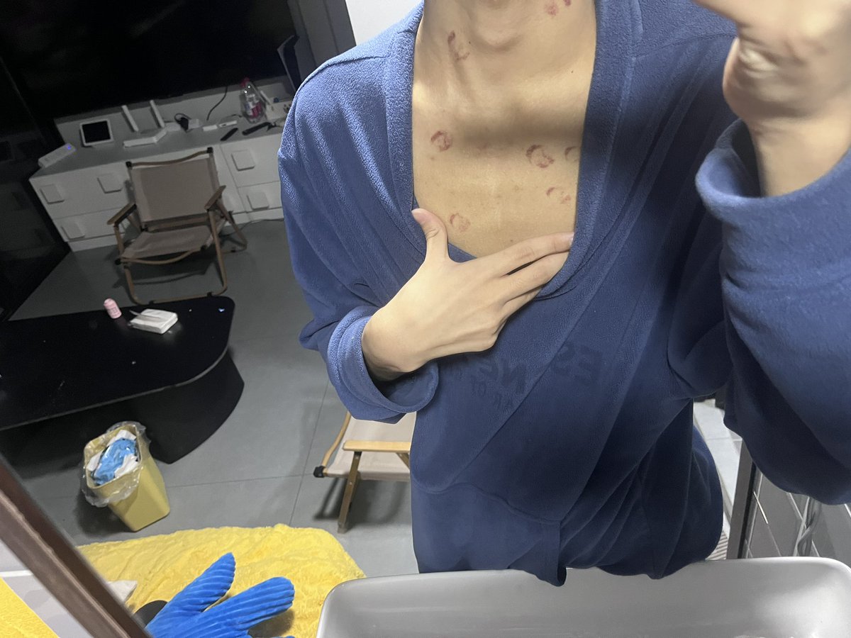 爱的印记🥰🥰