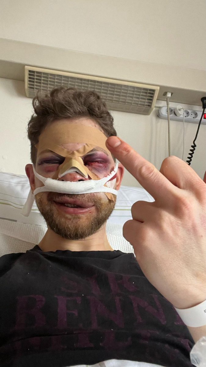 Brutale Attacke auf jüdischen
Studenten - ein Jahr später bleibt die Frage: Wie sicher sind unsere Unis?

Heute vor einem Jahr wurde der Student Lahav Shapira in Berlin fast totgeprügelt - von einem palästinensischen Kommilitonen! 

Der Grund? Er ist Jude.

Schwere Knochenbrüche,