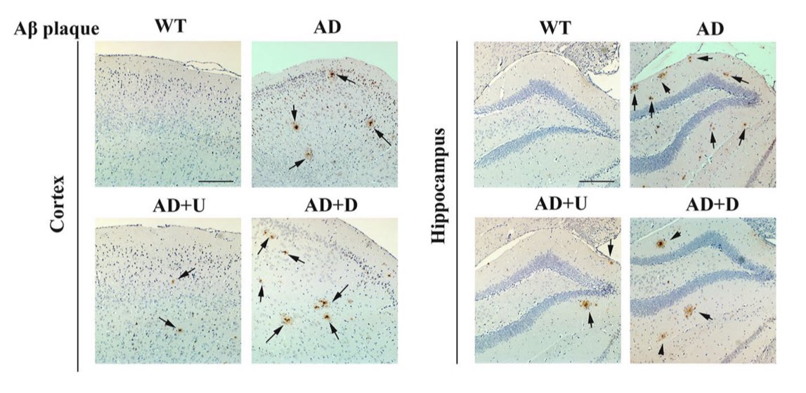 Could opioid receptors (OR) be a 🎯 of Alzheimer’s (AD) treatment?

A new study in a mouse model 🐁 of AD proposes delta OR agonist 🤔

alzres.biomedcentral.com/articles/10.11…

🔓(open access)