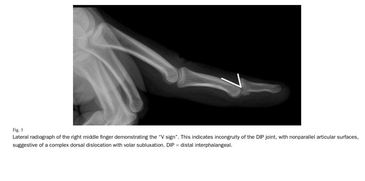 Terrence Jose Jerome, FRCS tweet media