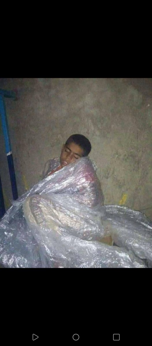 قال لي بأن الحوثي جعل صيت اليمن في القمه....لعن أبوك من قائل لا تعي ماحولك من مأسي...😔