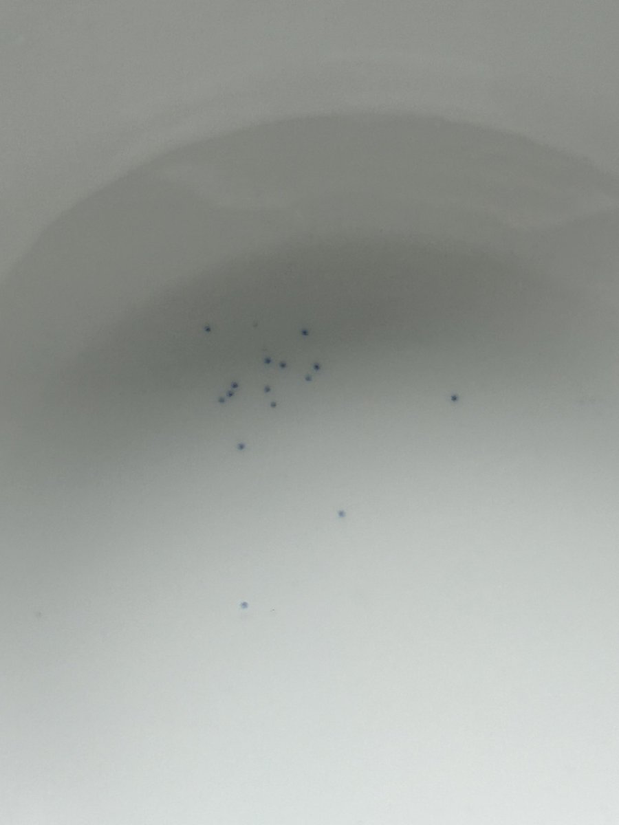 PhillyADI's tweet photo. @DwrCymru I’ve reported this a few times and some of your people have been out and can’t explain this. These blue grains are coming through my kitchen mixer tap and being caught in the filter. Can someone explain what they are as this is my main drinking water? https://t.co/E0YNQfGZlg