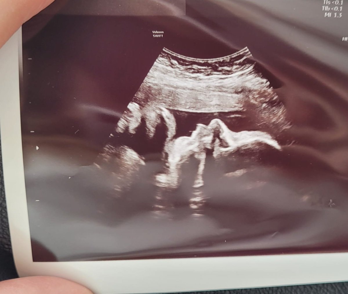 יש המון דברים שקיוויתי שיקרו לי בטוויטר, אבל מעולם לא דמיינתי את זה..