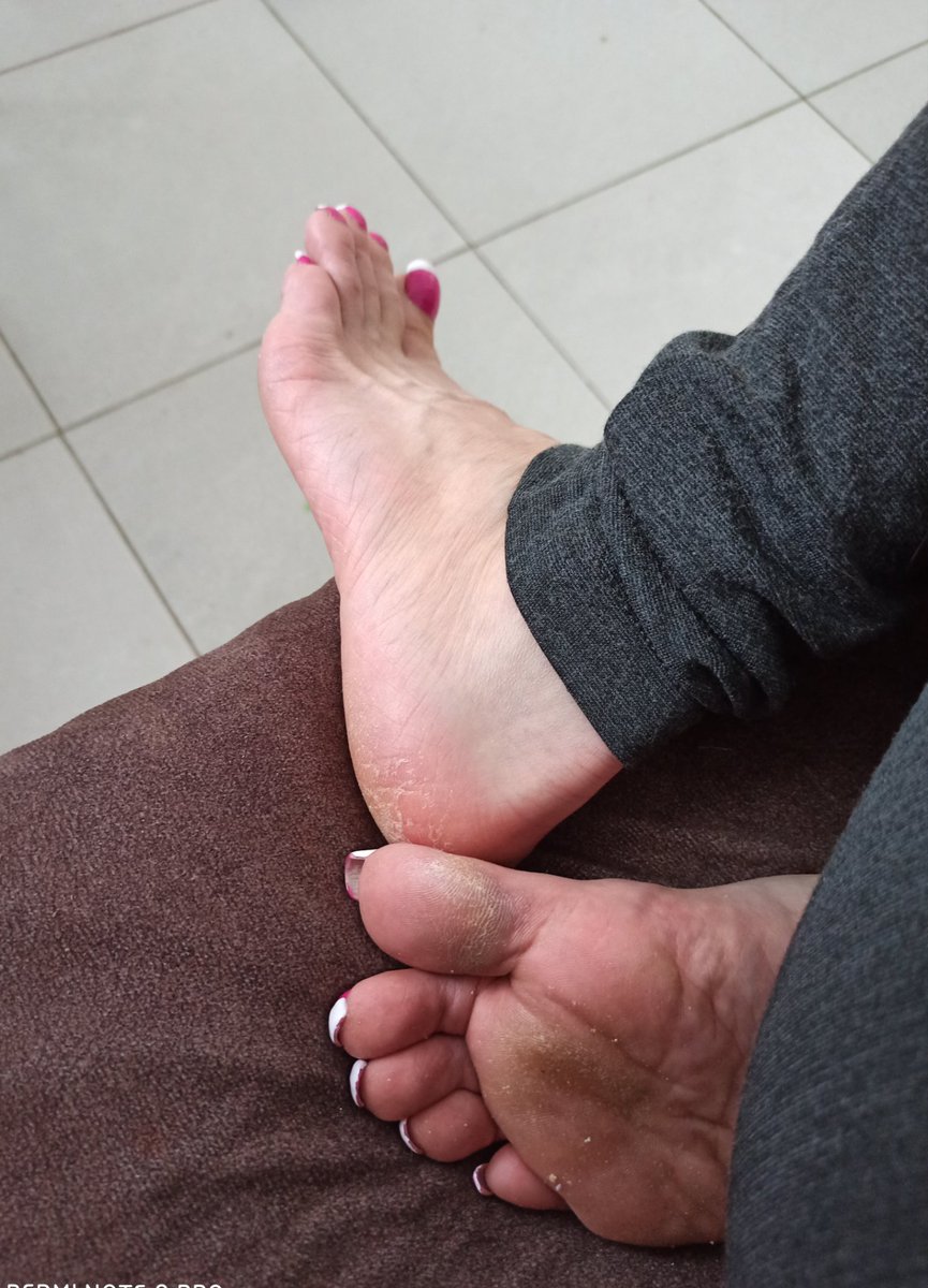 #Lika_toenails