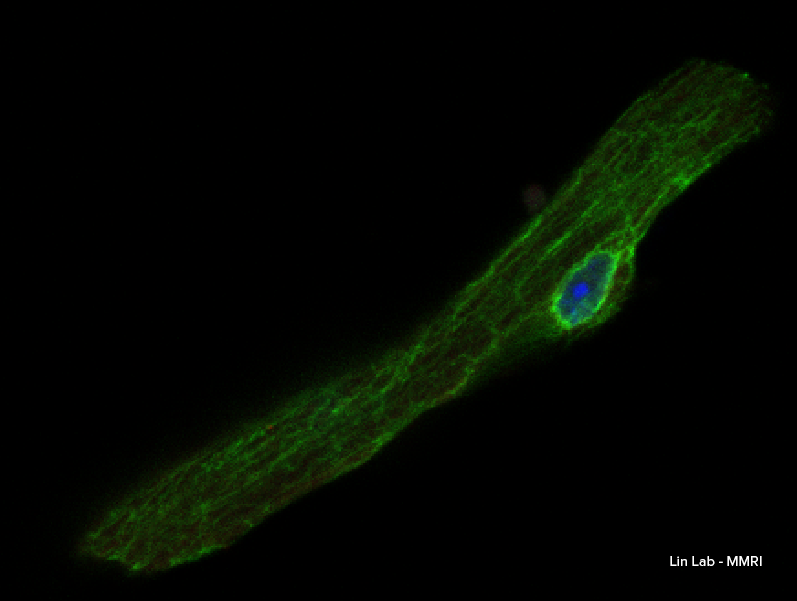 Pictured above in green are microtubules taken by the Lin Lab at MMRI. Microtubules are like the road network and structure of the cell. They are commonly referred to as the cell’s skeleton or cytoskeleton. 
Learn about our research here ➡️ mmri.edu