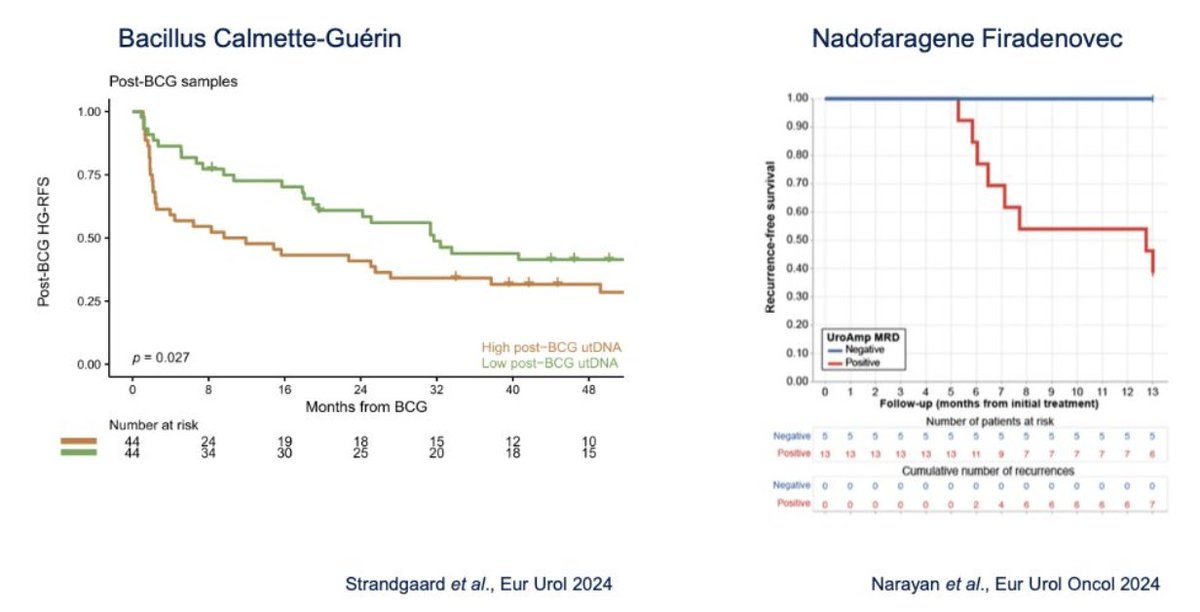 UroToday.com (@urotoday) on Twitter photo Beneath the Surface: Unleashing the Potential of ctDNA across the Spectrum of Urothelial Carcinoma. Presentation by <a href="/G_Vandekerkhove/">Gillian Vandekerkhove</a> <a href="/VanProstateCtr/">Vancouver Prostate Centre</a>. #GU25 written coverage by <a href="/chavarriagaj/">Julian Chavarriaga</a> <a href="/UofT/">University of Toronto</a> > bit.ly/41dXNqC Beneath the Surface: Unleashing the Potential of ctDNA across the Spectrum of Urothelial Carcinoma. Presentation by <a href="/G_Vandekerkhove/">Gillian Vandekerkhove</a> <a href="/VanProstateCtr/">Vancouver Prostate Centre</a>. #GU25 written coverage by <a href="/chavarriagaj/">Julian Chavarriaga</a> <a href="/UofT/">University of Toronto</a> > bit.ly/41dXNqC