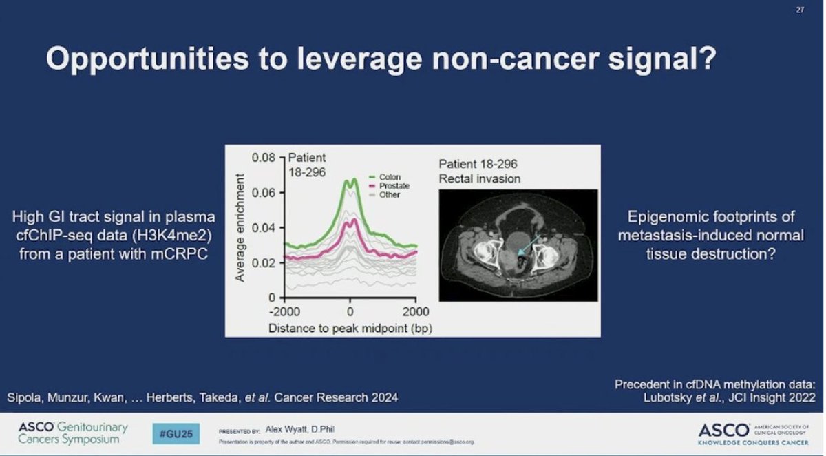 UroToday.com (@urotoday) on Twitter photo Evolution of ctDNA Detection with Next Generation Technology. Presentation by <a href="/ResearchWyatt/">Alex Wyatt</a> <a href="/VanProstateCtr/">Vancouver Prostate Centre</a>. #GU25 written coverage by <a href="/chavarriagaj/">Julian Chavarriaga</a> <a href="/UofT/">University of Toronto</a> > bit.ly/41eHSZc <a href="/ASCO/">ASCO</a> Evolution of ctDNA Detection with Next Generation Technology. Presentation by <a href="/ResearchWyatt/">Alex Wyatt</a> <a href="/VanProstateCtr/">Vancouver Prostate Centre</a>. #GU25 written coverage by <a href="/chavarriagaj/">Julian Chavarriaga</a> <a href="/UofT/">University of Toronto</a> > bit.ly/41eHSZc <a href="/ASCO/">ASCO</a>
