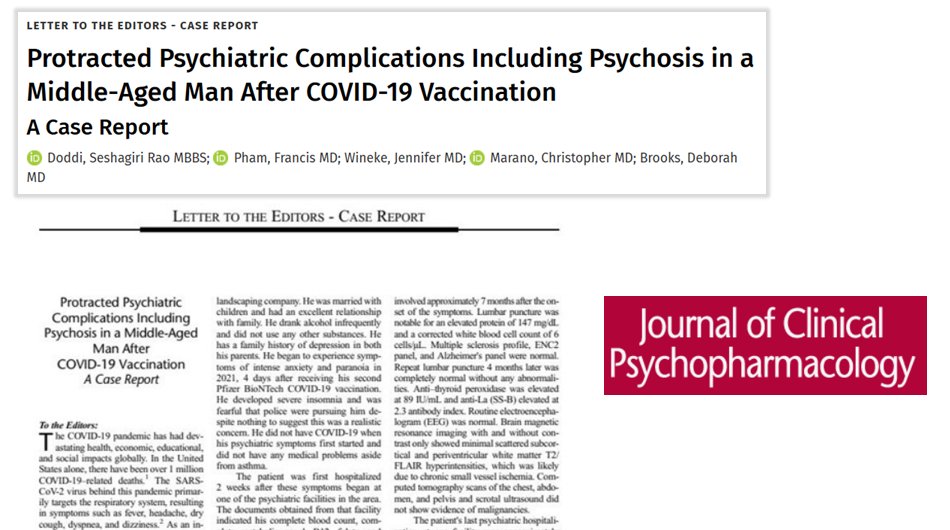 Psychiatric complications including psychosis in a middle-aged man after COVID-19 vaccination: A case report
journals.lww.com/psychopharmaco…
- A healthy middle-aged man
- "He began to experience symptoms of intense anxiety and paranoia in 2021, 4 days after receiving his 2nd Pfizer
