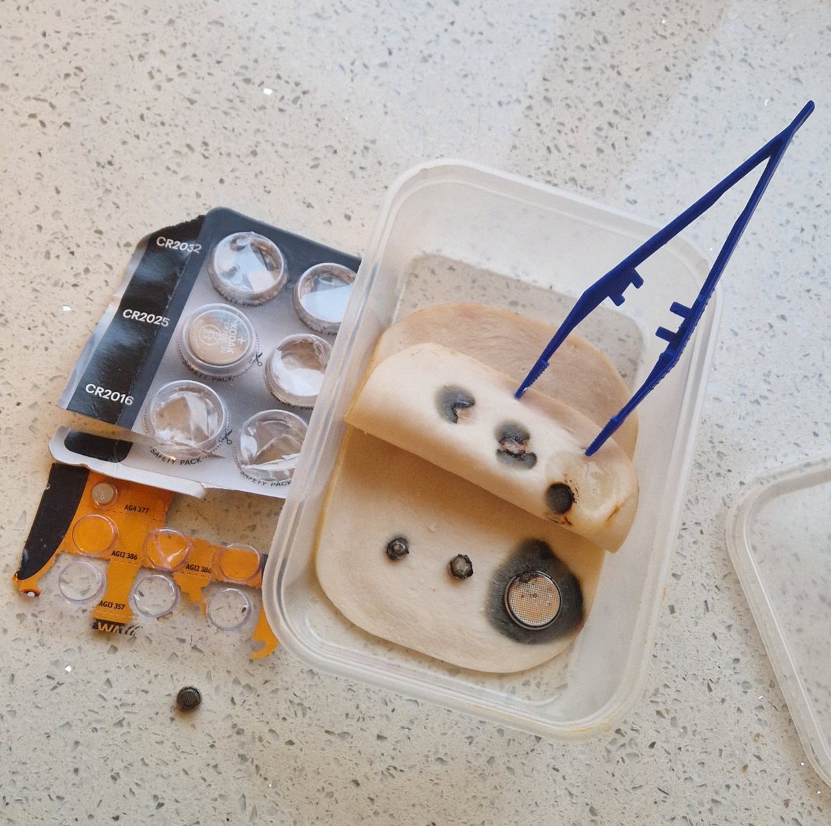 ConorHamilt0n's tweet image. Had a great day today at @QUBInterSim teaching about the dangers of swallowing button batteries and demonstrating endoscopic retrieval as part of @niscifest 
@QUBSONM @ICUReProgramme @innovateuk 
Image below demonstrates corrosive effect of batteries on GI tract @ 30 mins+