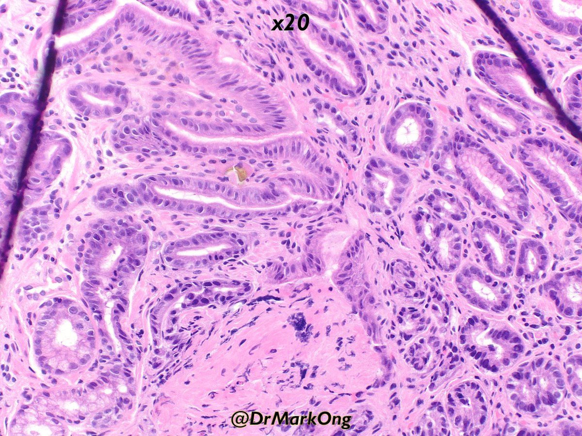 Mark Ong tweet media