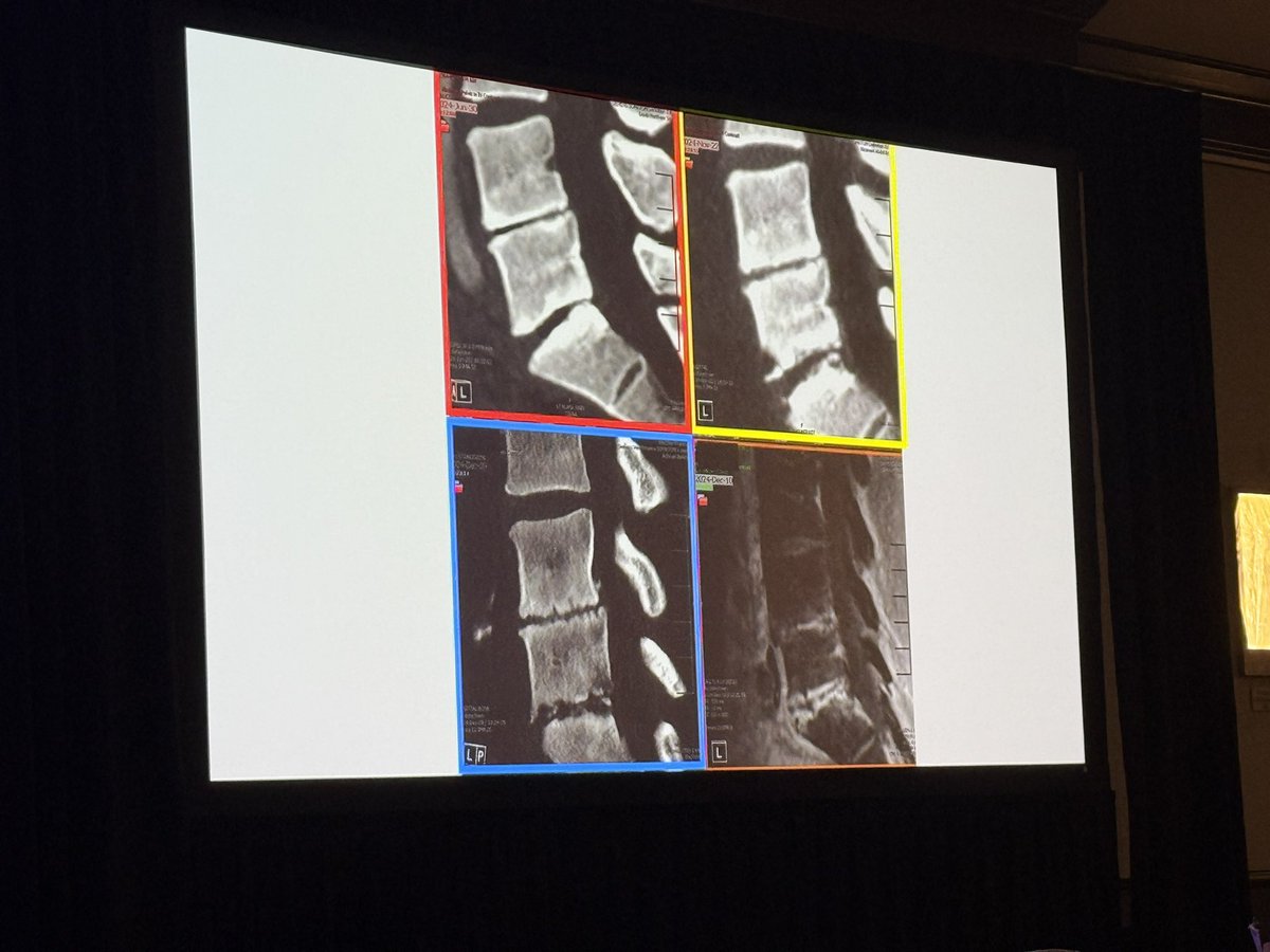 American Society of Spine Radiology (ASSR) tweet media