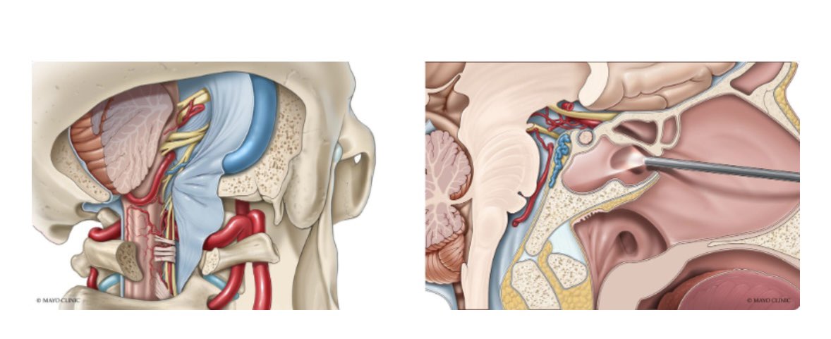 Maria Peris-Celda, MD PhD (@periscelda) on Twitter photo Registration open for the 2025 Open and Endoscopic Skull Base course!!! <a href="/MayoClinicNeuro/">Mayo Clinic Neuro</a> <a href="/MayoClinicENT/">Mayo Clinic ENT</a> July 23-26 Rochester, MN 3D, hands on dissections, virtual reality, cases
Register here 👇 ce.mayo.edu/neurology-and-… Registration open for the 2025 Open and Endoscopic Skull Base course!!! <a href="/MayoClinicNeuro/">Mayo Clinic Neuro</a> <a href="/MayoClinicENT/">Mayo Clinic ENT</a> July 23-26 Rochester, MN 3D, hands on dissections, virtual reality, cases
Register here 👇 ce.mayo.edu/neurology-and-…
