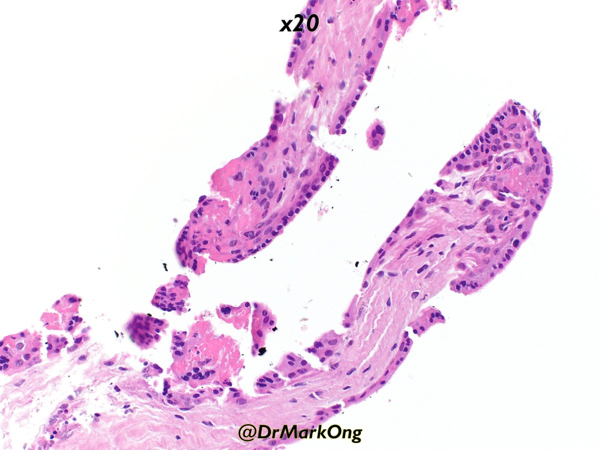 Mark Ong tweet media