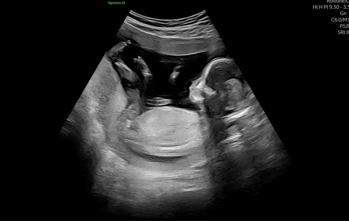 べらりんご tweet media